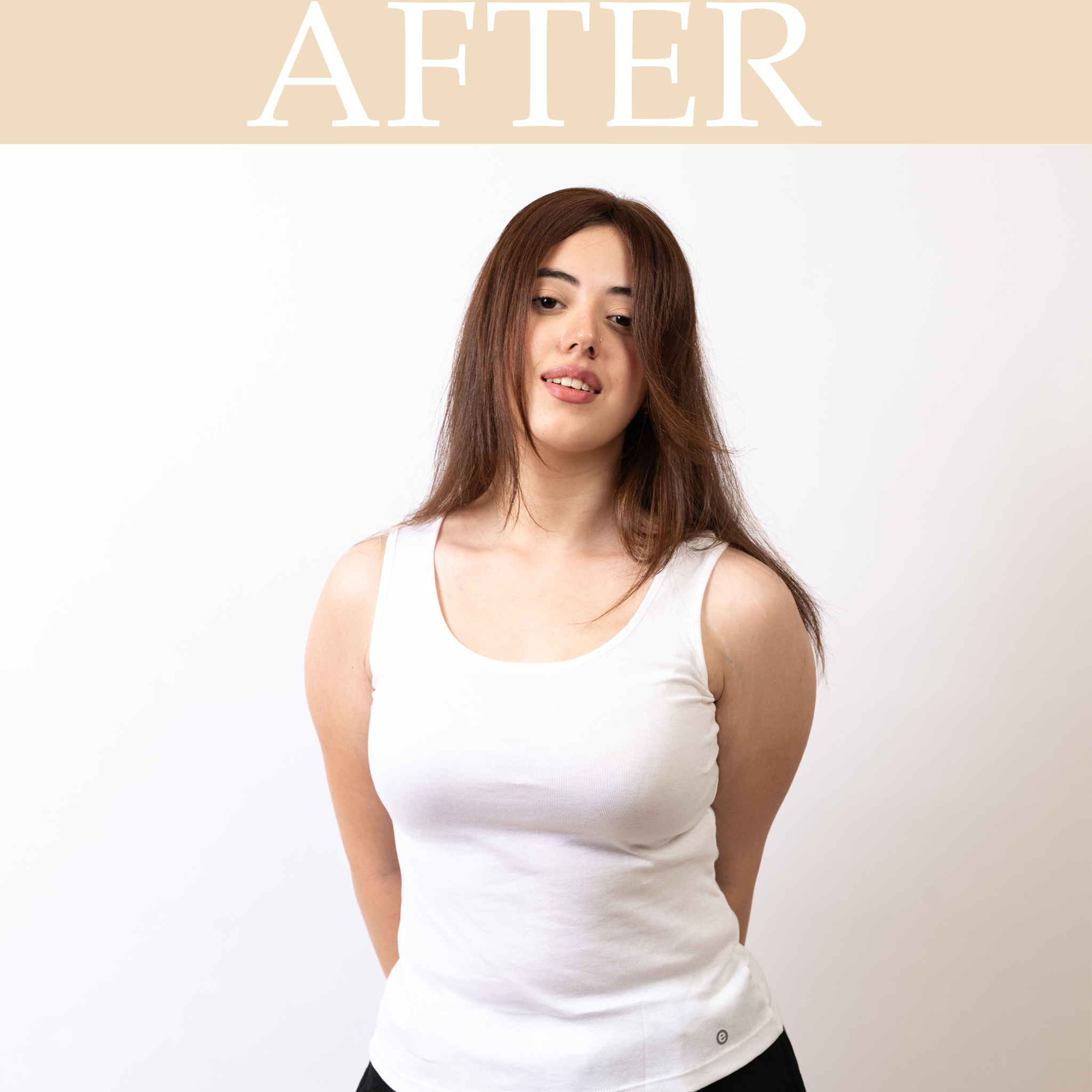 Front Hairline Topper